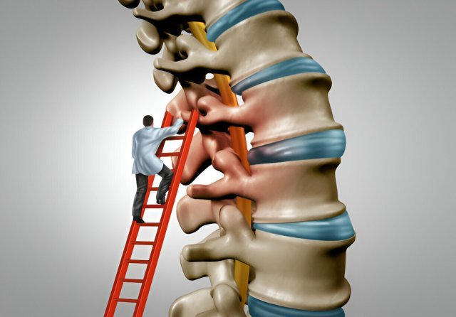 Spinal Stenosis