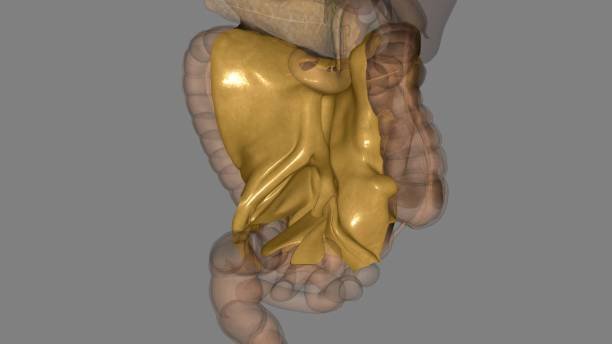 Transverse Colitis
