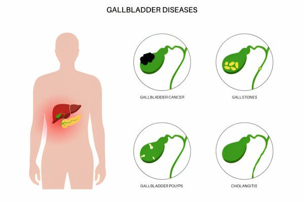 Gallbladder
