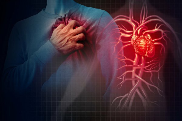 How Can I Rule Out A Heart Attack At Home? Heart Attack