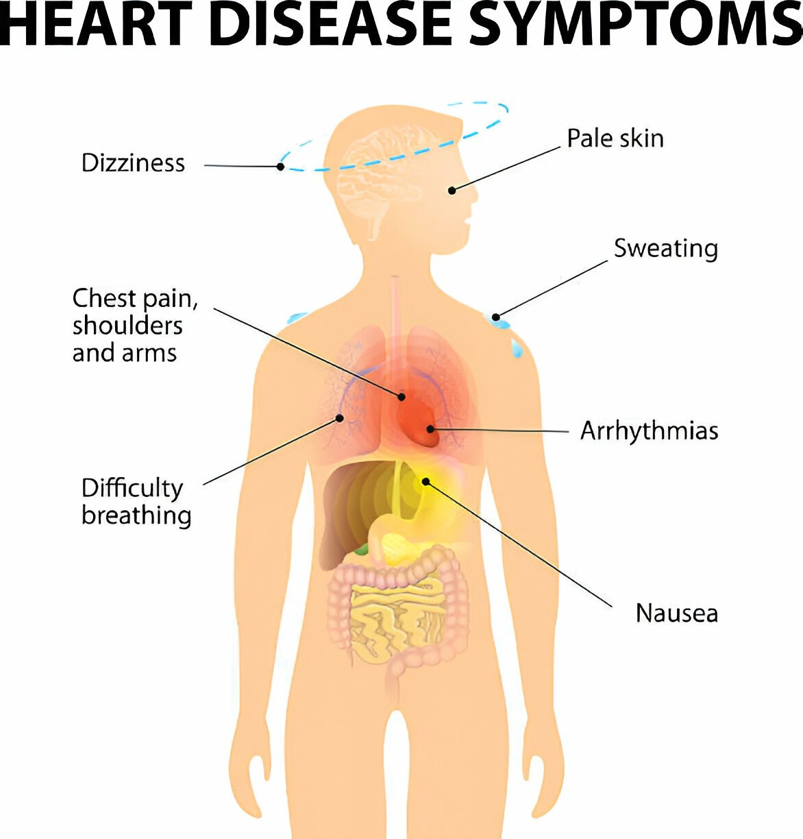 Heart Disease